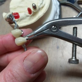 TOPDENT Teleskopzange mit diamantierten Arbeitsspitzen "Flipper" - schmal-lang