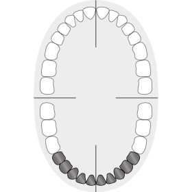 KKD® Kofferdam-Klammer Nr. 00 für kleine Prämolaren mit dünnem Zahnhals