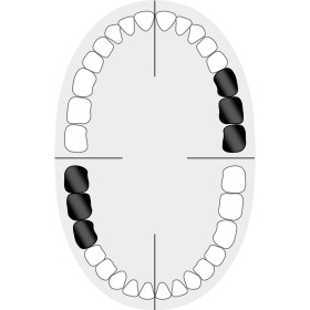 KKD_Zahnschema_Molaren_13A7