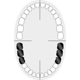 KKD_Zahnschema_Molaren_3+W3+7+W737