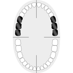 KKD_Zahnschema_Molaren_4+8+W26(N26)4