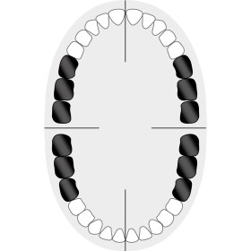 KKD_Zahnschema_Molaren_8A+W8A+14+14A25