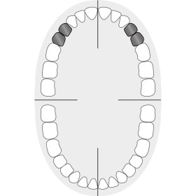 KKD_Zahnschema_Praemolaren_1+1T+W1-W292