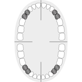 Kofferdam-Klammer Standard # 2AT